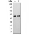 LifeSab™ 15-LO Rabbit pAb (50 µl)