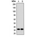 LifeSab™ CAC Rabbit pAb (50 µl)