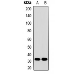 LifeSab™ CAC Rabbit pAb (50 µl)