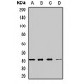 LifeSab™ Cystinosin Rabbit pAb (50 µl)