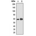 LifeSab™ PFKFB3 Rabbit pAb (50 µl)