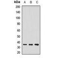 LifeSab™ Laforin Rabbit pAb (50 µl)
