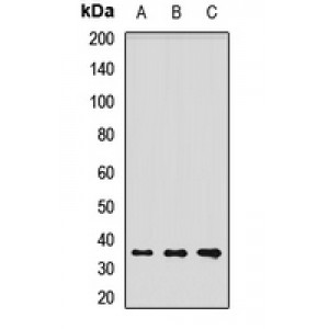 LifeSab™ Laforin Rabbit pAb (50 µl)