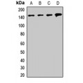LifeSab™ SMC1A Rabbit pAb (50 µl)