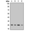 LifeSab™ ARD1 Rabbit pAb (50 µl)