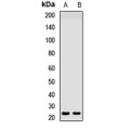 LifeSab™ HAND2 Rabbit pAb (50 µl)
