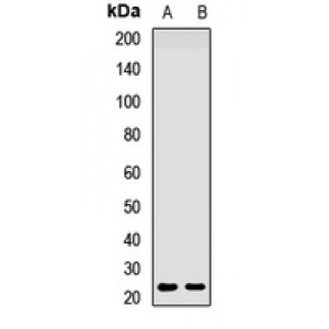 LifeSab™ HAND2 Rabbit pAb (50 µl)