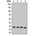 LifeSab™ COPS6 Rabbit pAb (50 µl)