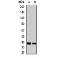 LifeSab™ TOB2 Rabbit pAb (50 µl)