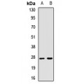 LifeSab™ NAT-15 Rabbit pAb (50 µl)