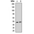 LifeSab™ Cytochrome P450 2C18 Rabbit pAb (50 µl)