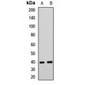 LifeSab™ TARBP2 Rabbit pAb (50 µl)