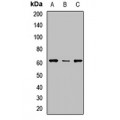LifeSab™ UGT2B10 Rabbit pAb (50 µl)
