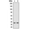 LifeSab™ TSARG2 Rabbit pAb (50 µl)