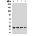 LifeSab™ PLCXD2 Rabbit pAb (50 µl)