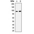 LifeSab™ Sortilin Rabbit pAb (50 µl)