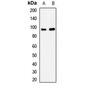 LifeSab™ Sortilin Rabbit pAb (50 µl)
