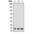 LifeSab™ RNF166 Rabbit pAb (50 µl)