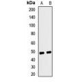 LifeSab™ Ferrochelatase Rabbit pAb (50 µl)
