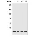 LifeSab™ NDUFA7 Rabbit pAb (50 µl)