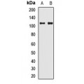 LifeSab™ Synaptopodin Rabbit pAb (50 µl)