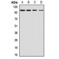 LifeSab™ SMEK1 Rabbit pAb (50 µl)