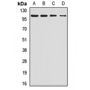 LifeSab™ SMEK1 Rabbit pAb (50 µl)