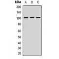 LifeSab™ SAP97 Rabbit pAb (50 µl)