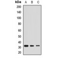 LifeSab™ Calretinin Rabbit pAb (50 µl)