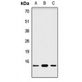LifeSab™ NDUFA6 Rabbit pAb (50 µl)