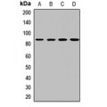 LifeSab™ PTK7 Rabbit pAb (50 µl)