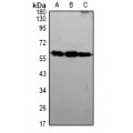 LifeSab™ GLUT2 Rabbit pAb (50 µl)
