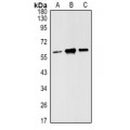 LifeSab™ Estrogen Receptor beta Rabbit pAb (50 µl)