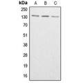 LifeSab™ ABL1/2 (pY393/439) Rabbit pAb (50 µl)