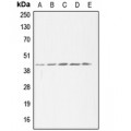 LifeSab™ ACAT1 Rabbit pAb (50 µl)