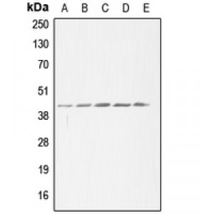 LifeSab™ ACAT1 Rabbit pAb (50 µl)