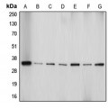 LifeSab™ Aquaporin 4 Rabbit pAb (50 µl)