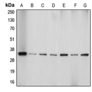 LifeSab™ Aquaporin 4 Rabbit pAb (50 µl)