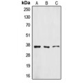 LifeSab™ ZFP36L1 Rabbit pAb (50 µl)