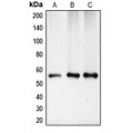 LifeSab™ CHK1 Rabbit pAb (50 µl)