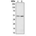 LifeSab™ CRHR2 Rabbit pAb (50 µl)