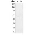 LifeSab™ CK1 epsilon Rabbit pAb (50 µl)