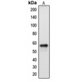 LifeSab™ Cytochrome P450 2A13 Rabbit pAb (50 µl)