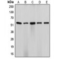 LifeSab™ Cytochrome P450 17A1 Rabbit pAb (50 µl)