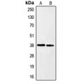 LifeSab™ Ephrin A3 Rabbit pAb (50 µl)