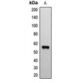 LifeSab™ ETV1 Rabbit pAb (50 µl)