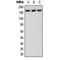 LifeSab™ FANCA (pS1149) Rabbit pAb (50 µl)
