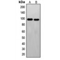 LifeSab™ c-FER Rabbit pAb (50 µl)