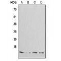 LifeSab™ Amylin Rabbit pAb (50 µl)