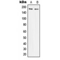 LifeSab™ IRS1 Rabbit pAb (50 µl)